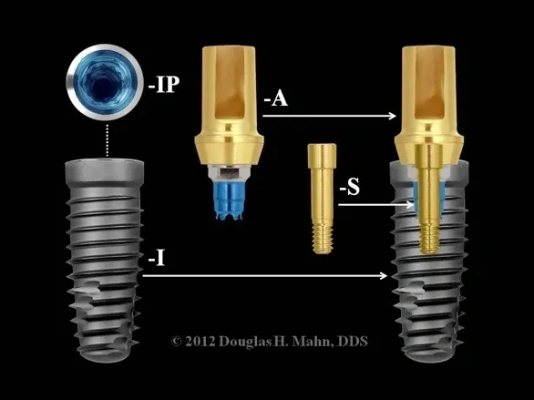 A picture of an implant and its components.