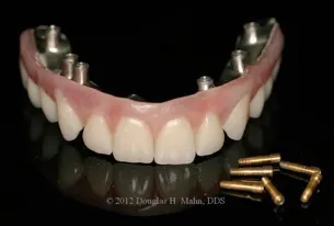A close up of a denture with some bullets