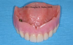 A close up of the inside of an artificial denture